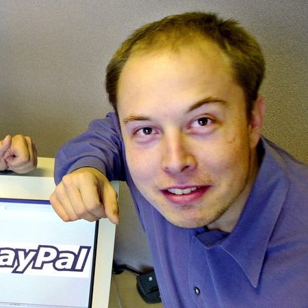 Before hair transplant