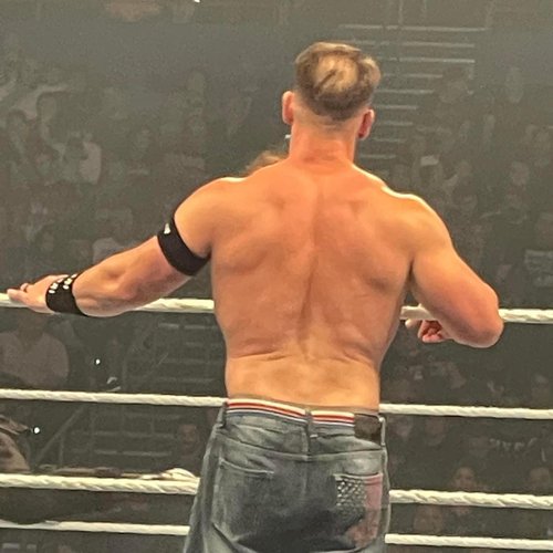 Before hair transplant