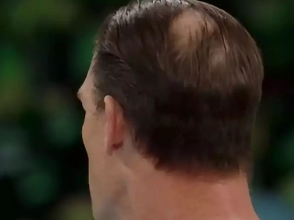 2024-april-wrestlemania-john-cena-bald-spot