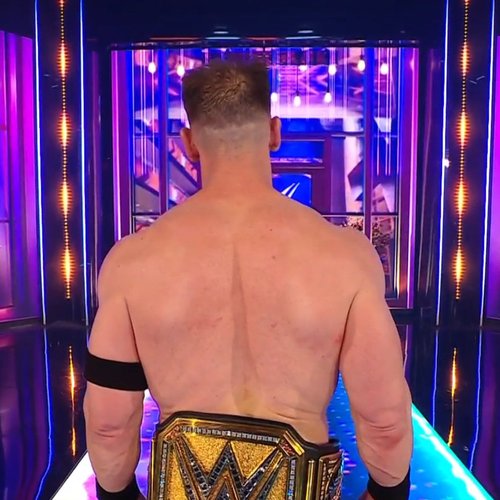 After hair transplant